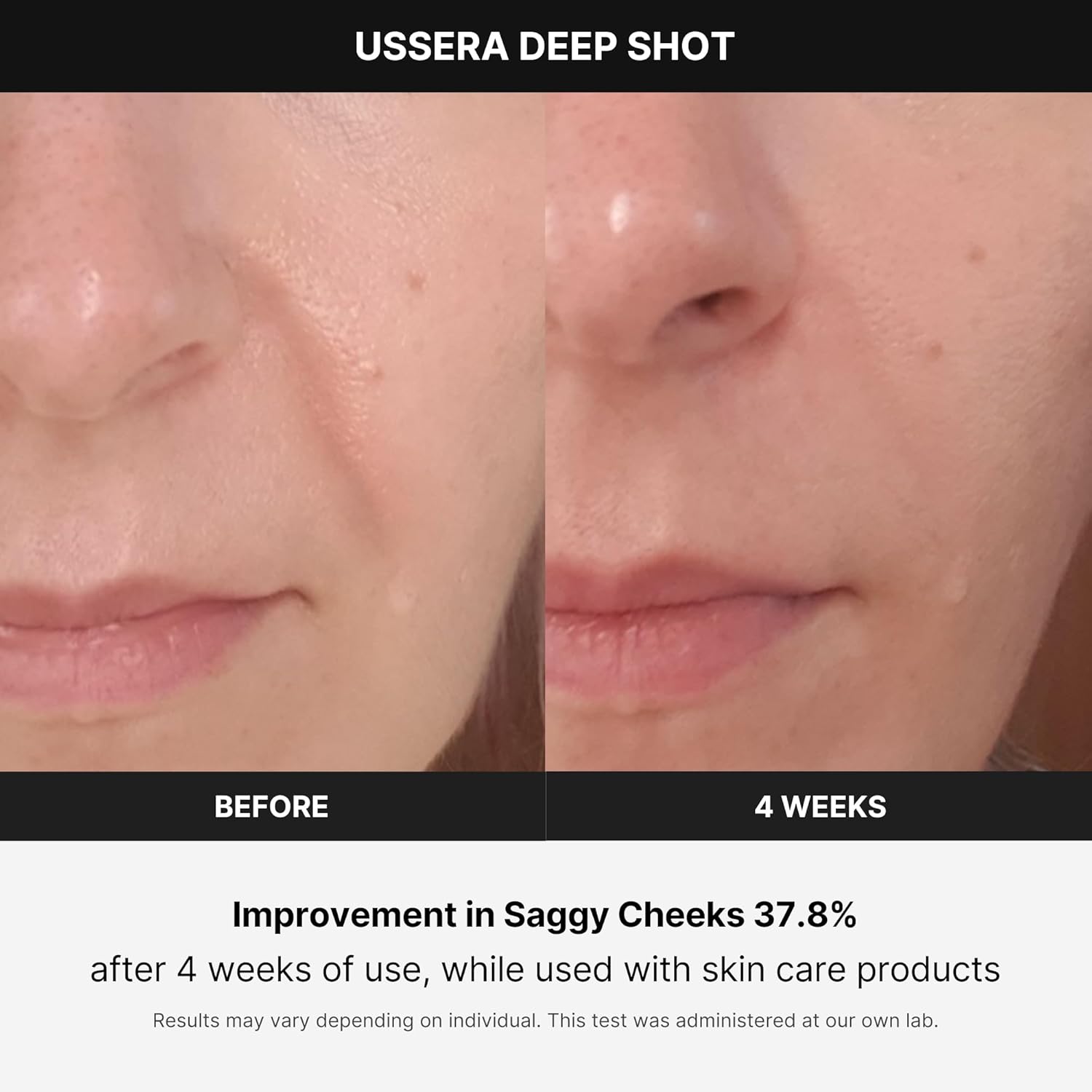 Medicube Age-R USSERA Deep Shot Yaşlanma Önleyici Bakım Cihazı