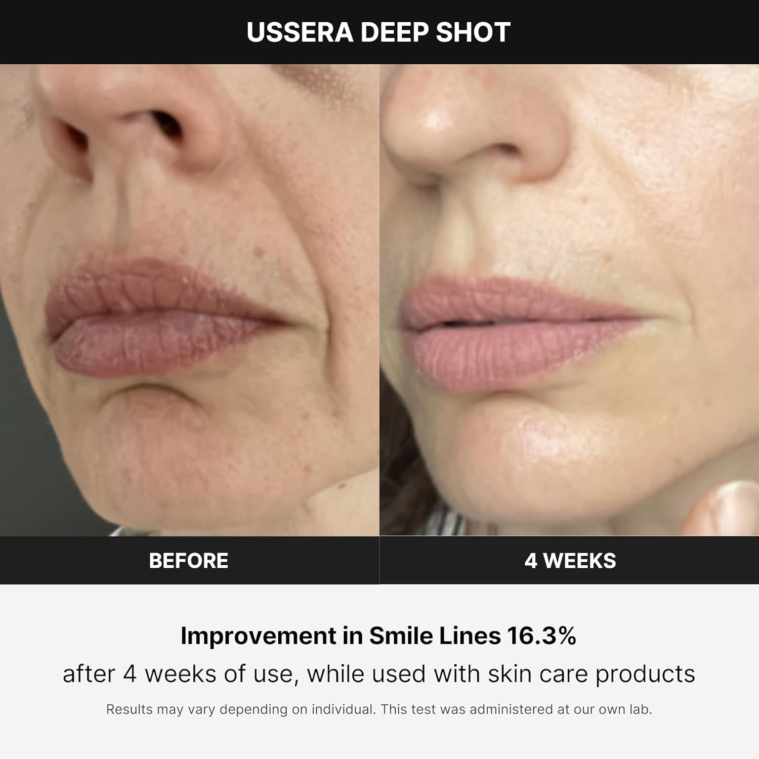 Medicube Age-R USSERA Deep Shot Yaşlanma Önleyici Bakım Cihazı