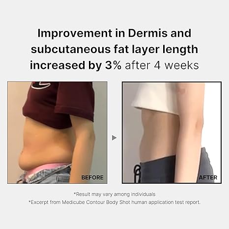 Medicube Age-R Contour Body Shot - Vücut İnce Şekillendirme Cihazı